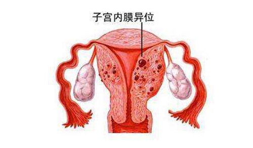 深圳女性尿道炎都有哪些症状