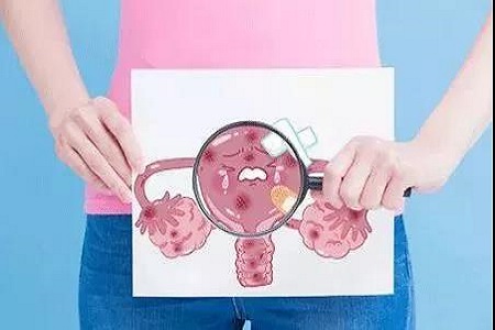 妇女子宫肌瘤引起的因素是什么